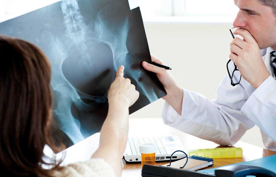 doktori koji rendgenski pregledavaju artrozu kuka